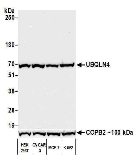 Anti-UBQLN4/CIP75/Ubiquilin 4 Recombinant Monoclonal