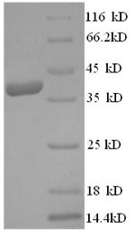 Dermcidin (DCD), human, recombinant