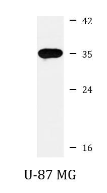Anti-MRPL45