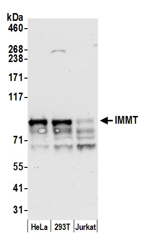 Anti-IMMT/Mitofilin