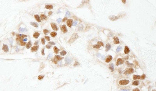 Anti-PARP1 (IHC)