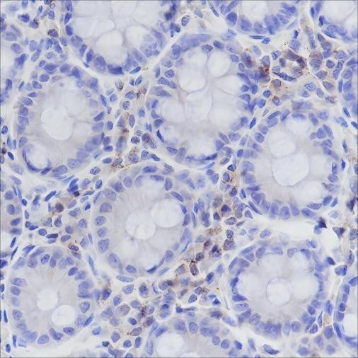 Anti-Recombinant CD50/ICAM3, clone A176