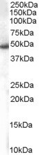 Anti-SNX5