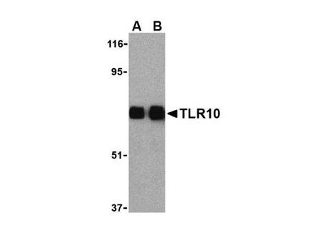 Anti-TLR10 (Toll Like Recptor-10)