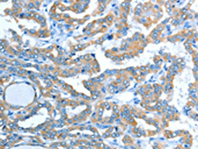 Anti-ALDH3B1