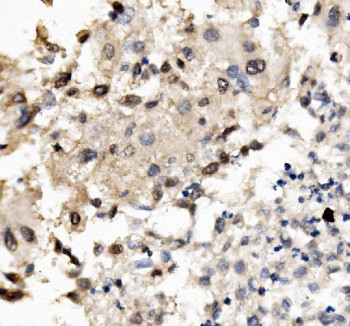 Anti-MNT / Max-binding protein MNT