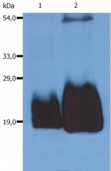 Anti-CD59, clone MEM-43/5