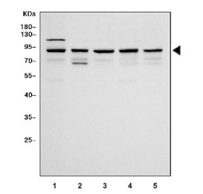 Anti-Specificity Protein 1 / SP1