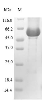 Lysosomal acid glucosylceramidase (GBA), human, recombinant