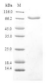 Ribonucleoside-diphosphate reductase subunit M2 B (RRM2B), human, recombinant