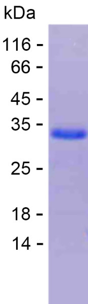 Recombinant Human COL11A2 Protein