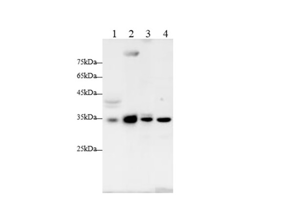 Anti-CCND1