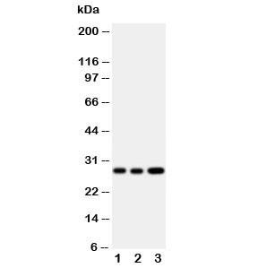 Anti-Oncostatin M