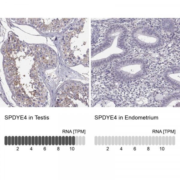Anti-SPDYE4