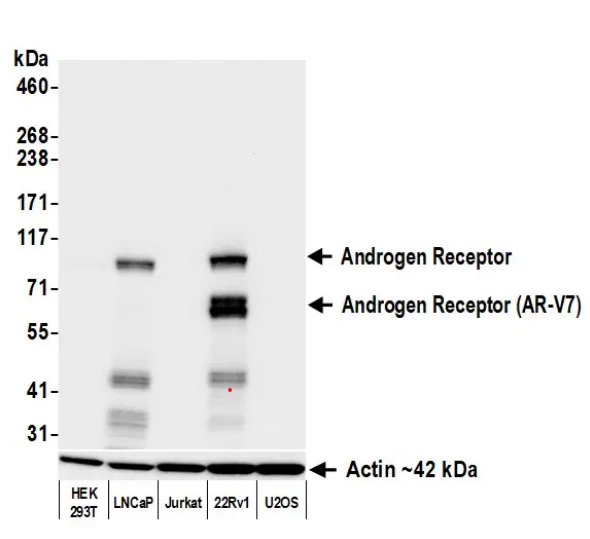 Anti-Androgen Receptor Recombinant Monoclonal