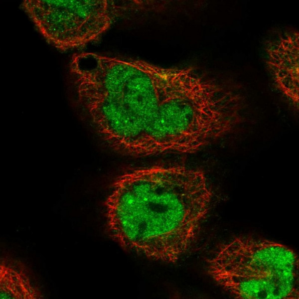 Anti-NIPAL3