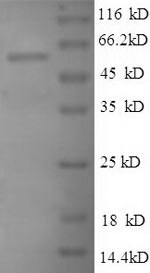 Large ribosomal subunit protein uL3 (RPL3), partial, recombinant human