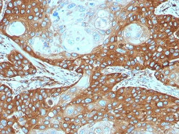Anti-RPSA / 40S Ribosomal protein SA, clone RPSA/2699