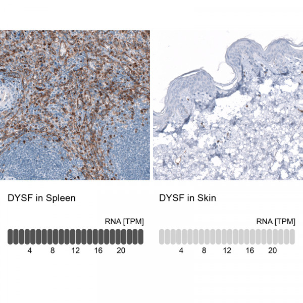 Anti-DYSF, clone CL10888