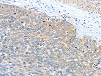 Anti-WNT3A