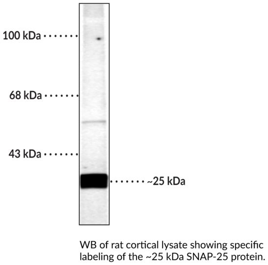 Anti-SNAP-25 Polyclonal Antibody (Clone D005)