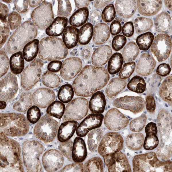 Anti-PEBP4