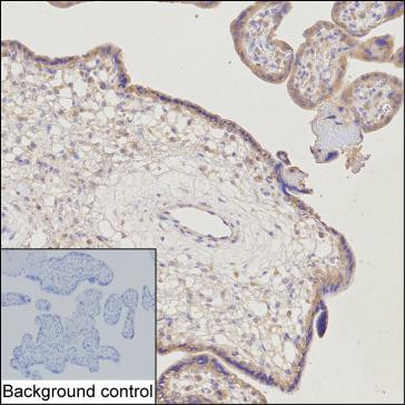 Anti-C1QTNF1