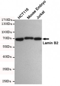 Anti-Lamin B2, clone 8F6-E8-F12