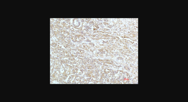Anti-a-actinin (4A12), monoclonal