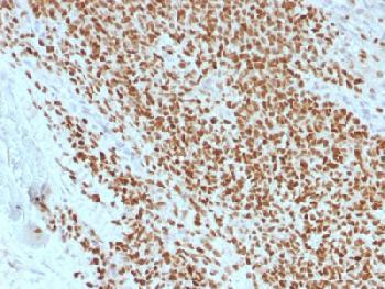 Anti-NKX2.2 (Neuroendocrine &amp; Ewing s Sarcoma Marker) Recombinant Mouse Monoclonal Antibody (clone:r