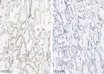 Anti-Phospho-CREB (Ser133) Monoclonal Recombinant Antibody