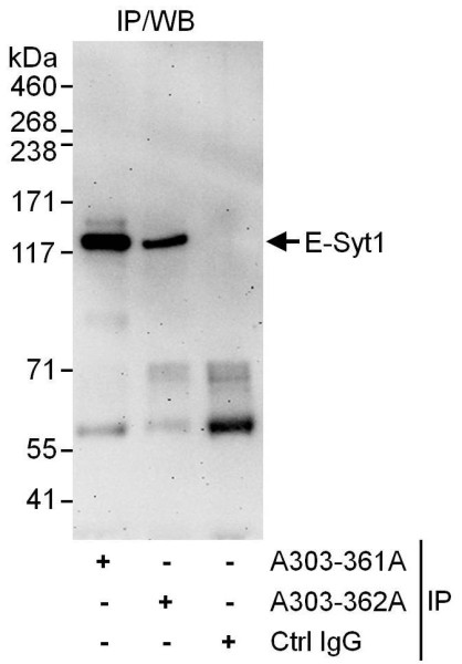Anti-E-Syt1