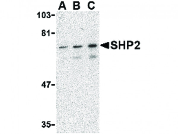 Anti-SHP2