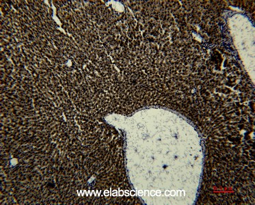 Anti-Transferrin, clone 1B12