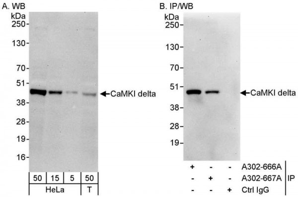 Anti-CaMKI delta
