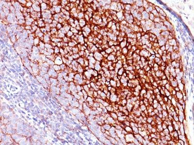 Anti-CD35 / CR1 (Follicular Dendritic Cell Marker)(Clone: SPM554)