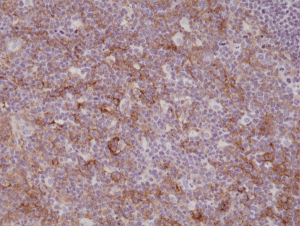 Anti-CD11b (human), Rabbit Monoclonal (RM290)