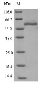 Epoxide hydrolase 1 (EPHX1), human, recombinant