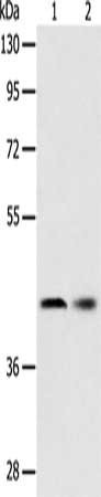 Anti-SERPINA5