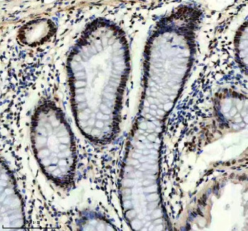 Anti-Prospero homeobox protein 1 / PROX1, clone AOGA-16