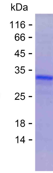 CASR (human), recombinant protein