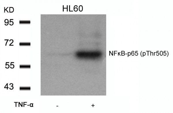 Anti-phospho-NFkB p65 (Thr505)