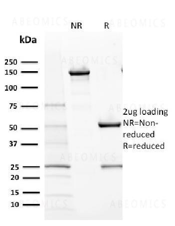 Anti-CD117 / c-Kit (Marker for Gastrointestinal Stromal Tumors) Monoclonal Antibody (Clone: KIT/2670
