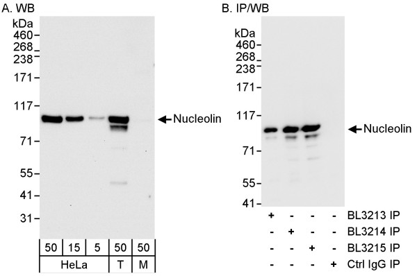 Anti-Nucleolin (NCL)