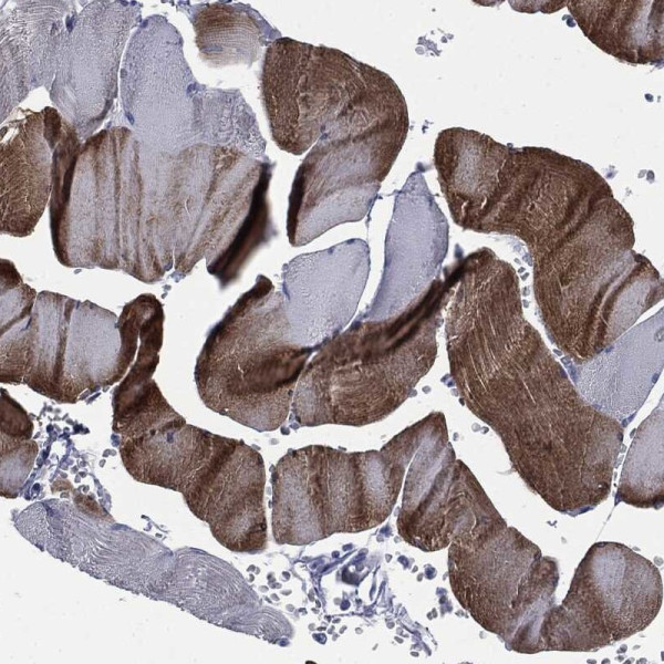 Anti-ATP2A1