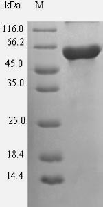 Guanine nucleotide-binding protein G (s) subunit alpha isoforms short (GNAS), human, recombinant