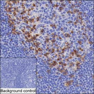 Anti-PDCD1