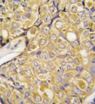 Anti-TRPM8