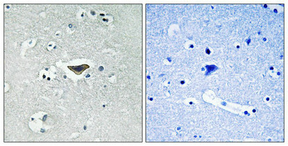 Anti-Phospho-RASGRF1 (Ser916)