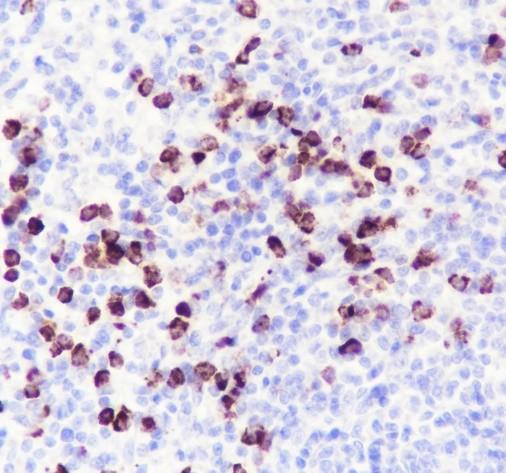 Anti-Recombinant MMP8, clone A579